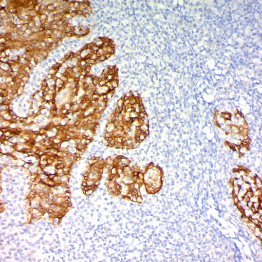 Cytokeratin (Pan); Clone Cocktail (Ready-To-Use)